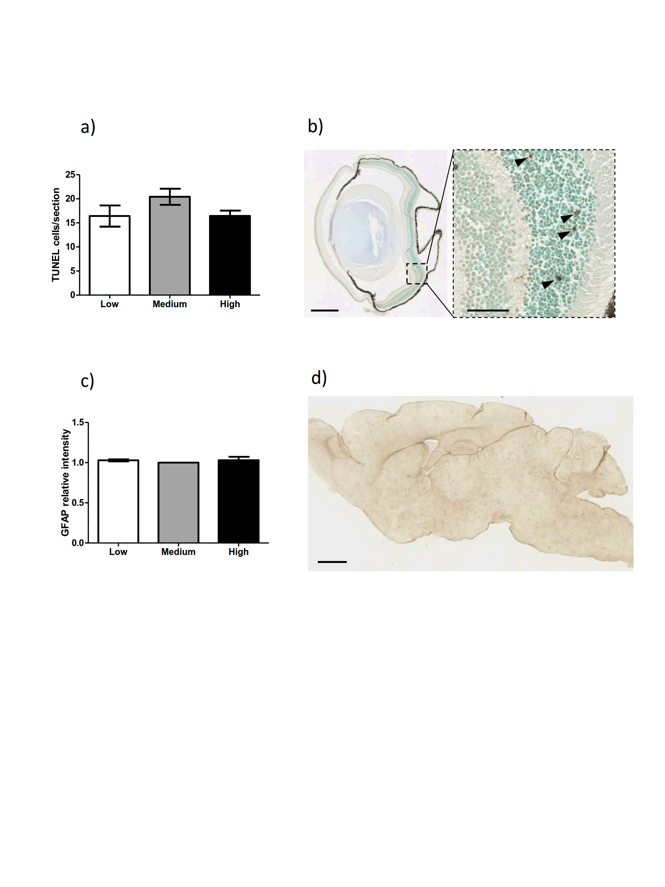 Figure 4. Vitamin E does not affect retina degeneration and astrogliosis in Xpg-/- mice