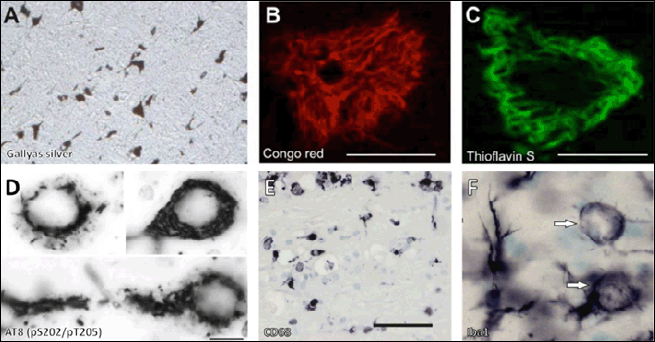 Figure 1. Rat models expressing truncated tau 151-391/4R faithfully recapitulate human neurofibrillary tau pathology