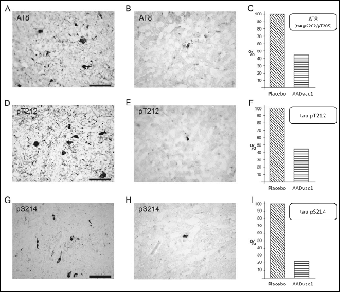 Figure 2. Active vaccination reduced the number of transgenic rats developing extensive neurofibrillary pathology